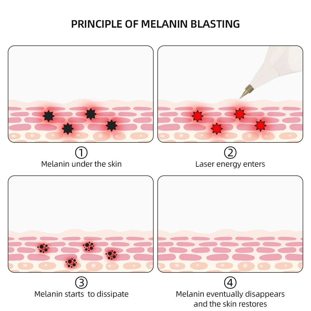 Beauco Plasma Pen